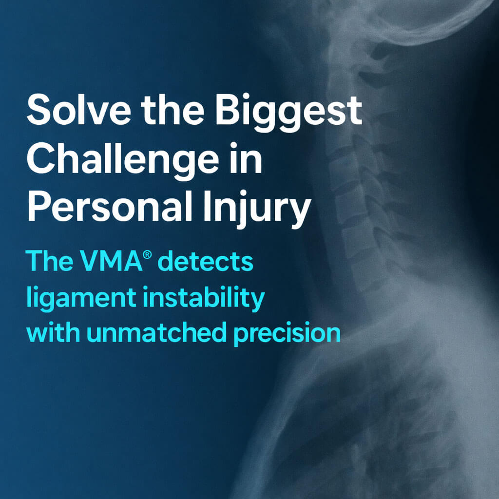 Where Motion-Based Diagnosis Matters Most
